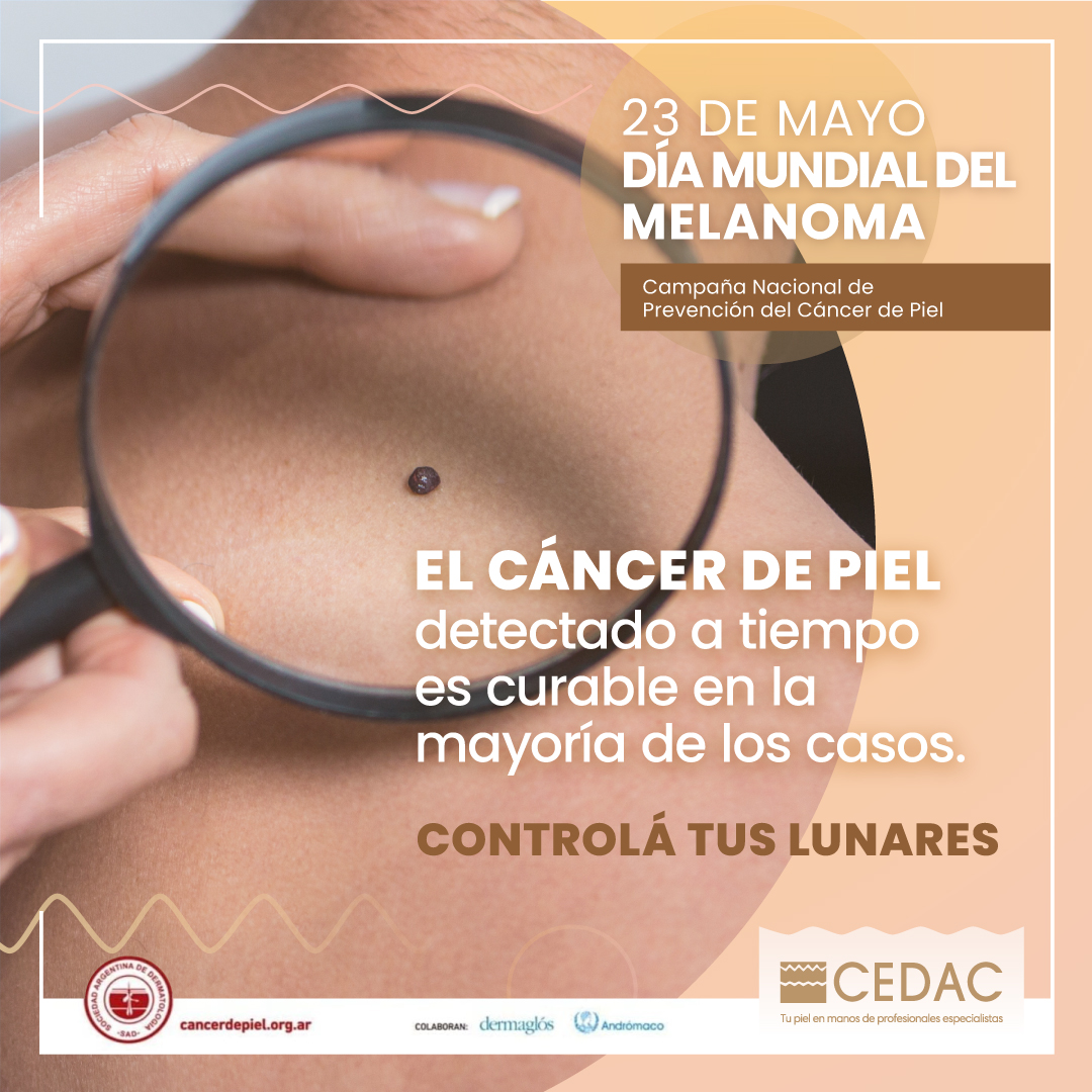 CEDAC Día Melanoma