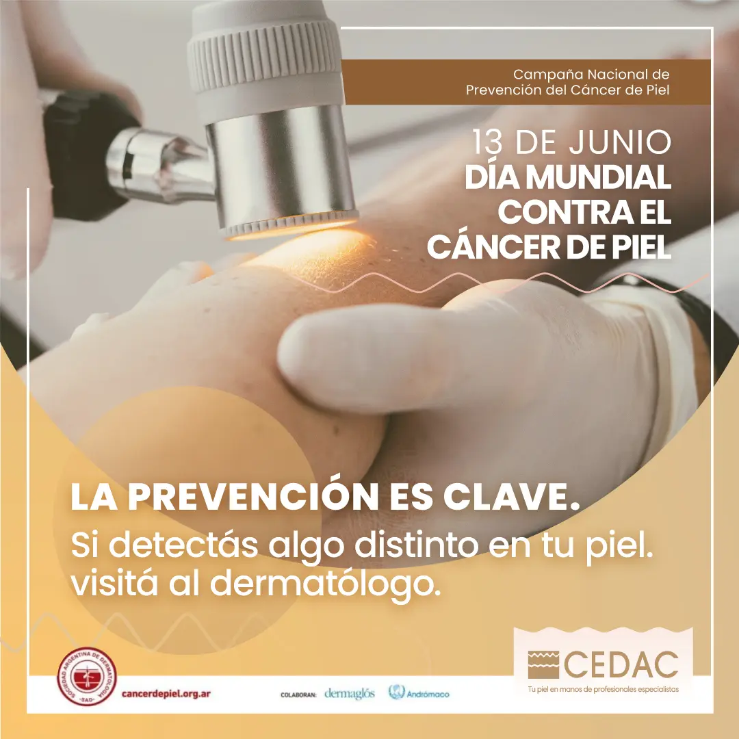 CEDAC Día Cáncer de Piel