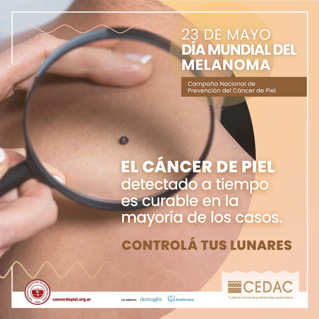 CEDAC Día Melanoma